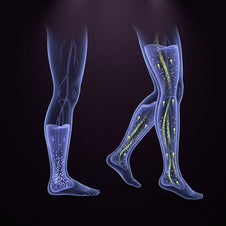 Why Do My Legs Feel Heavy?